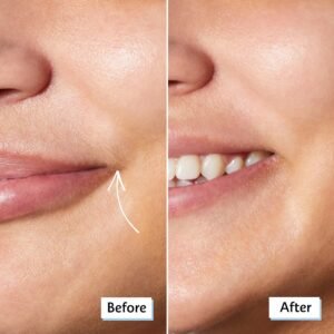 Facial Razor By Peice